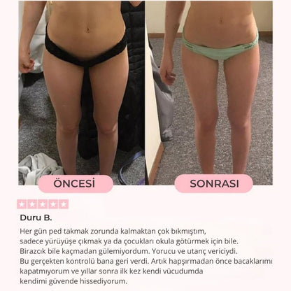 Velora Fit - Pelvik Kası Çalıştırıcı